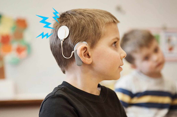 Pediatric Cochlear Implant Surgery: What Parents Need to Know